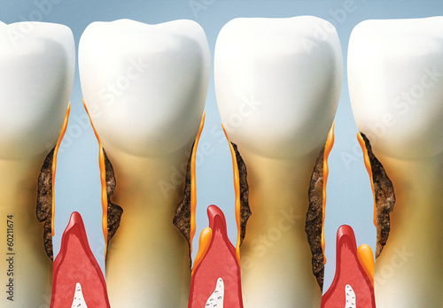 treat your teeth, periodontal photo