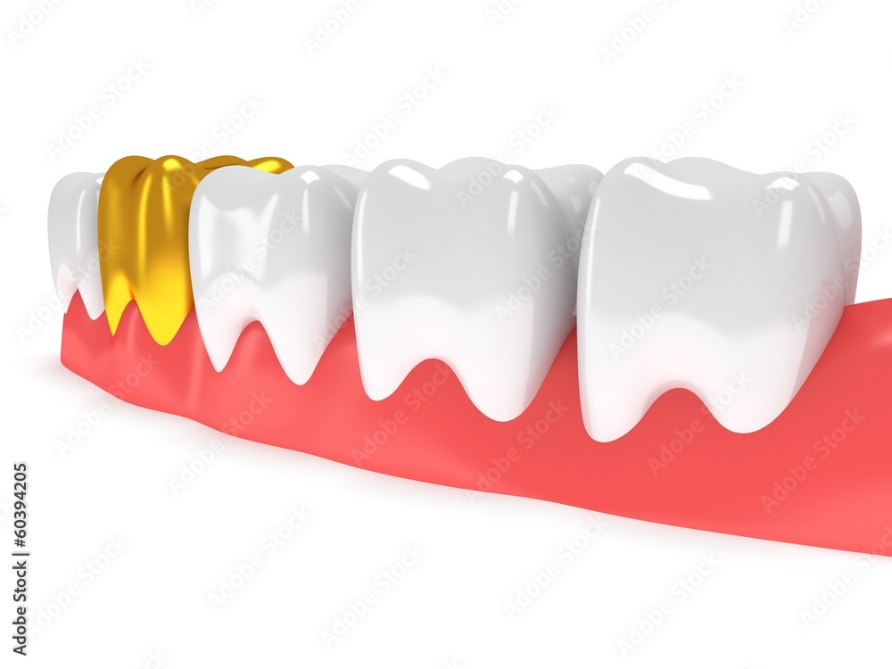 Obraz premium Teeth on gingiva isolated on white back.