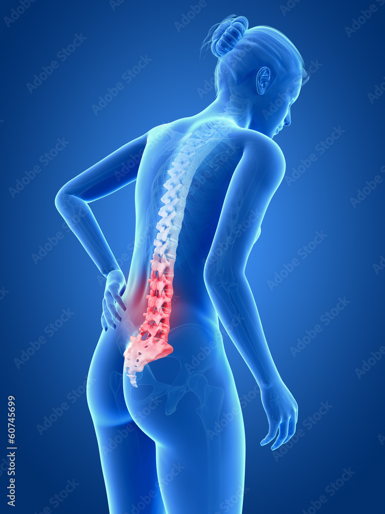 3d rendered medical illustration - Acute pain in a woman´s back. 3d rendered medical illustration - Acute pain in a woman´s back.