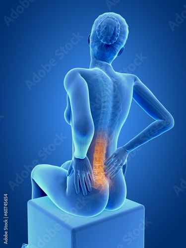 3d rendered medical illustration - Acute pain in a woman´s back. photo