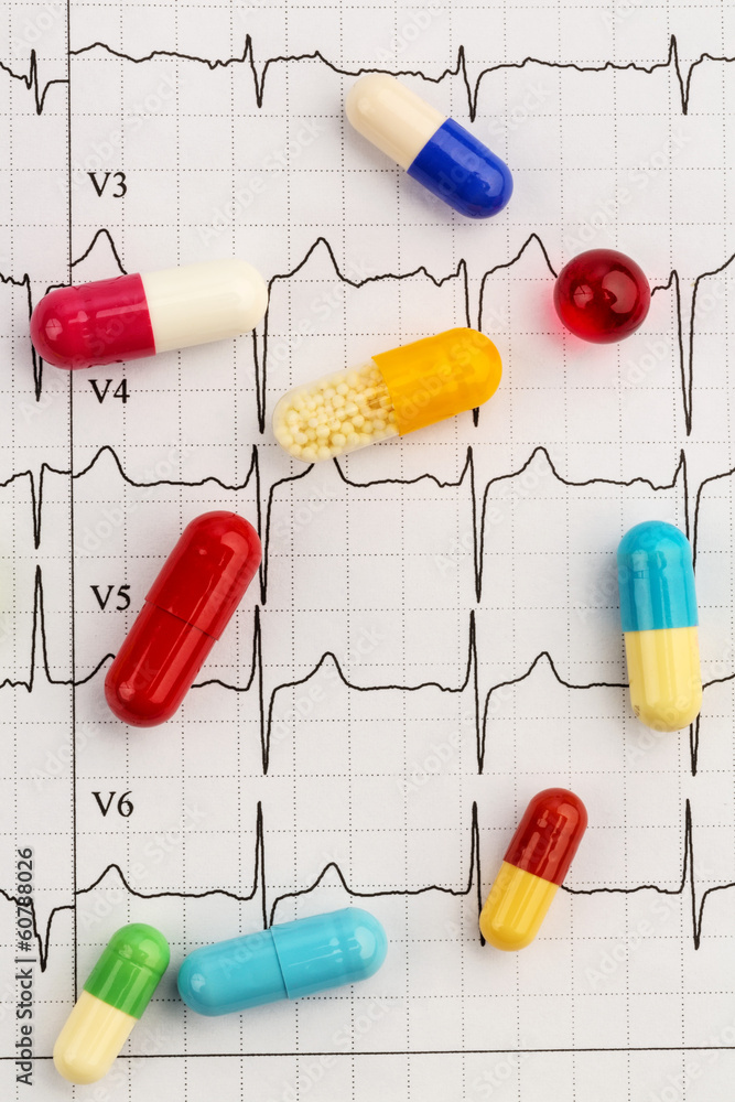 tablets on an ecg tablets on an ecg