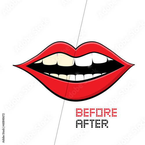 Vector Mouth on White Background Cleaning Teeth