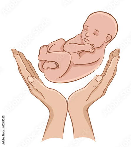 Custody baby