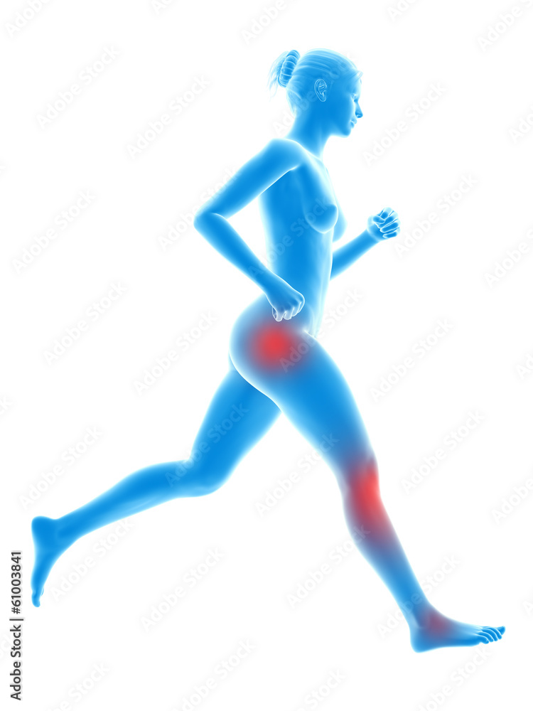 3d rendered illustration - woman having painful leg joints