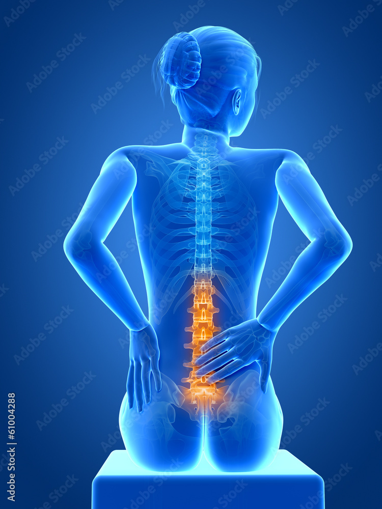 3d rendered illustration - woman having acute pain in the back 3d rendered illustration - woman having acute pain in the back