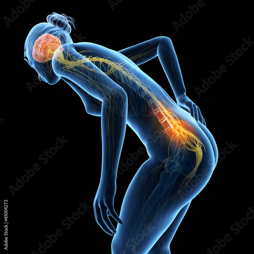 3d rendered illustration - woman having acute pain in the back photo