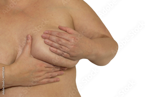 Frau prüft Brust Mastopathie oder Krebs