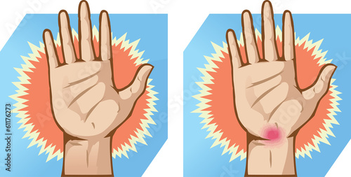 Hand pain