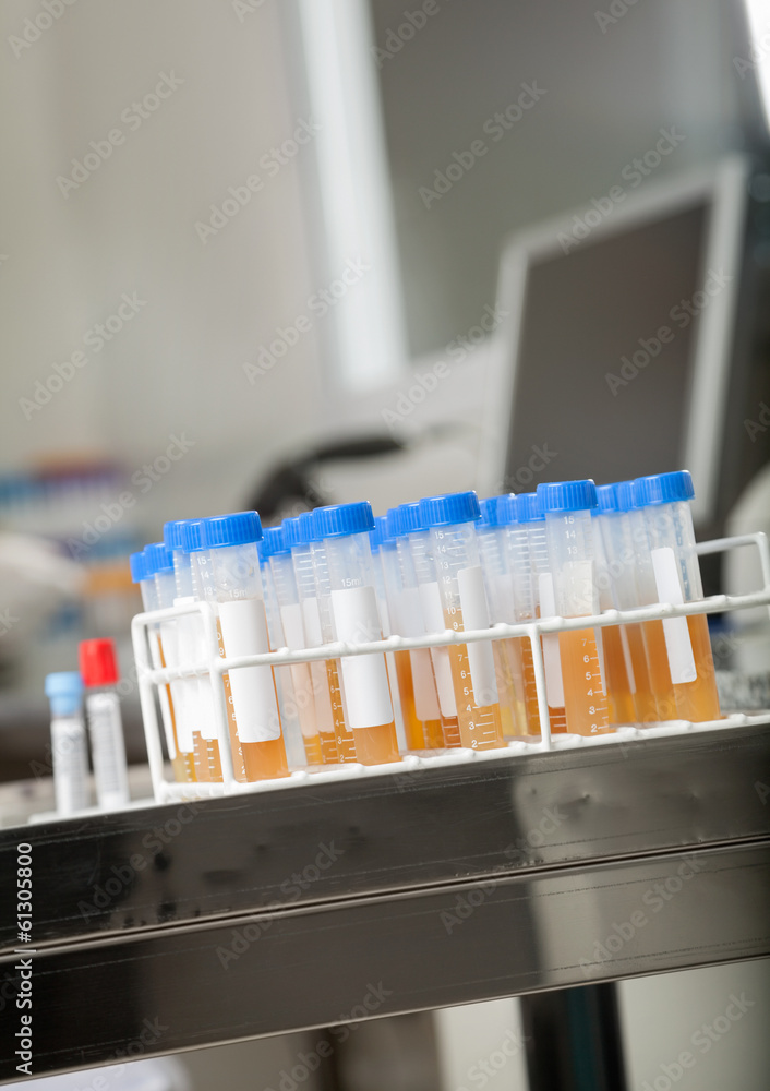 Test Tubes In Medical Laboratory Test Tubes In Medical Laboratory