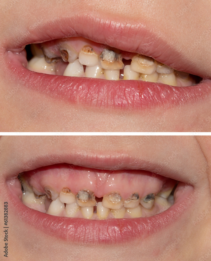 Naklejka premium Dental medicine and healthcare - human patient open mouth showin