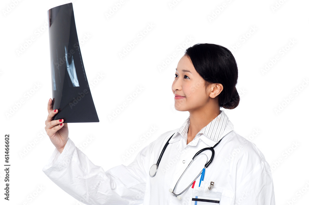 Female doctor looking at scanned x-ray report Female doctor looking at scanned x-ray report
