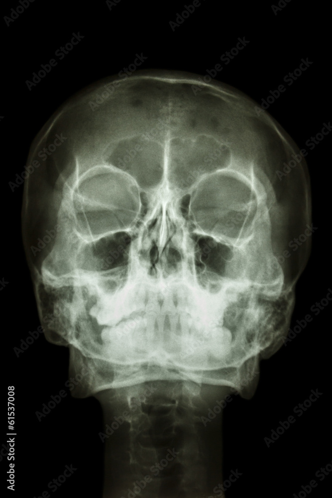 normal human's skull and cervical spine normal human's skull and cervical spine