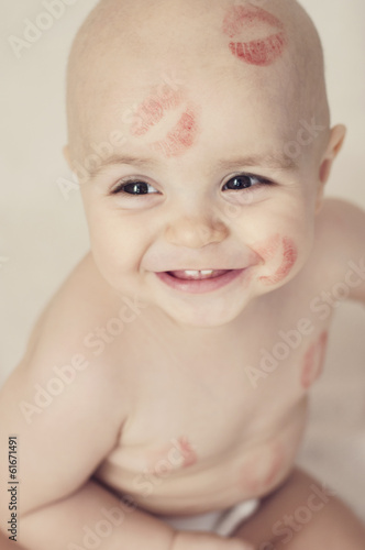 Happy child with red kisses on the skin