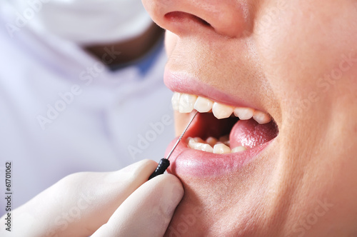 dentist examines teeth