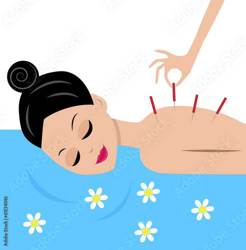young woman accept procedure acupuncture