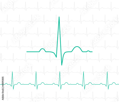 EKG symbol on white - vector medical background