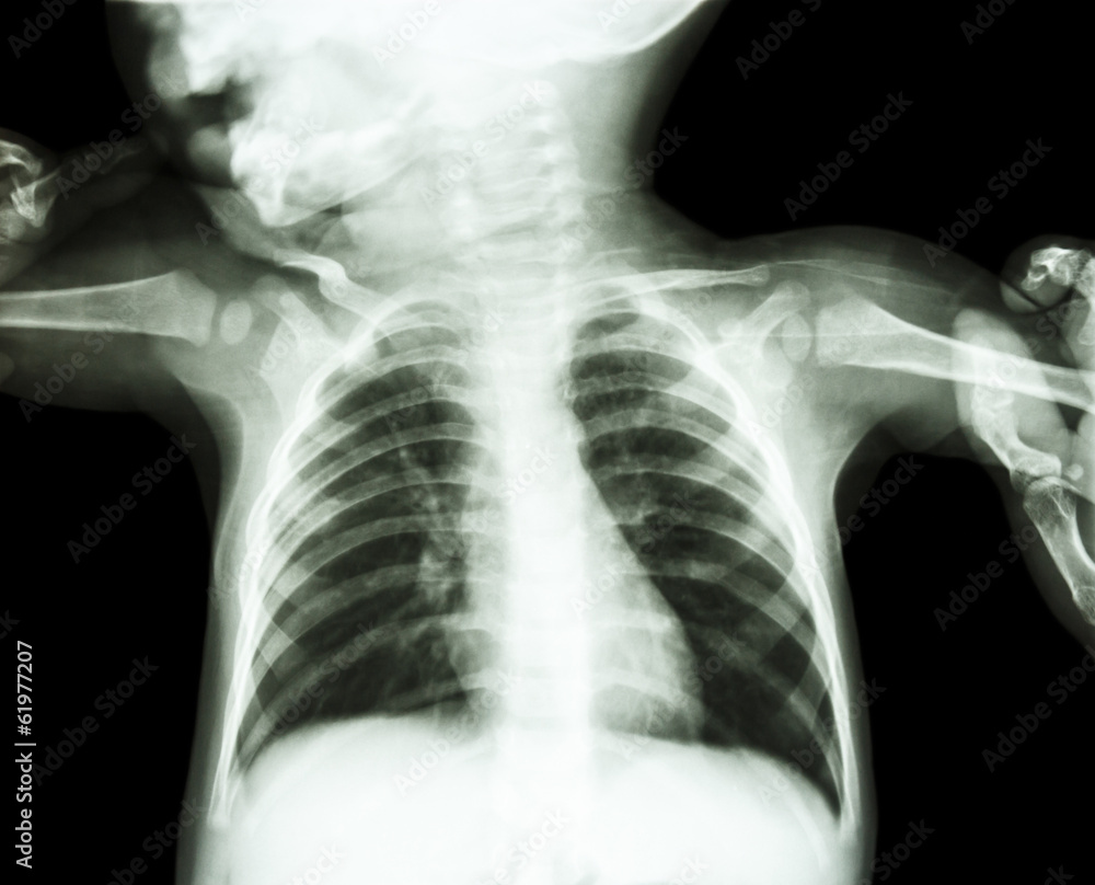 body of child and adult is holding at both child's arm body of child and adult is holding at both child's arm