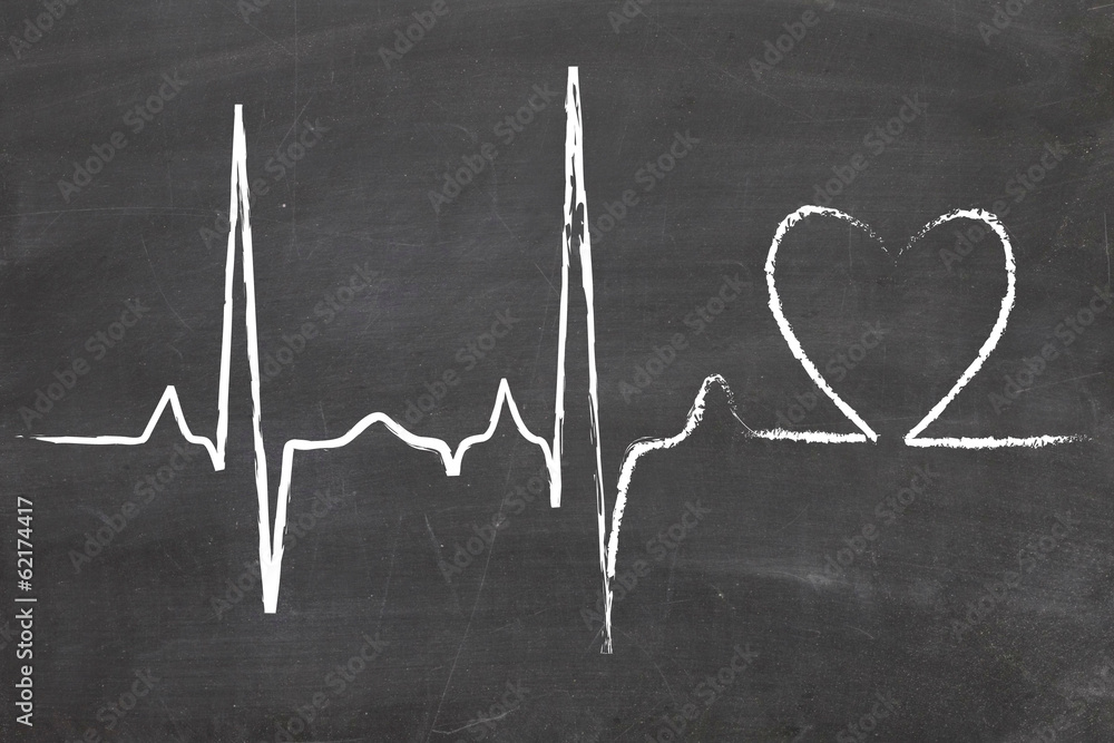 EKG - heart rate Stock Illustration | Adobe Stock