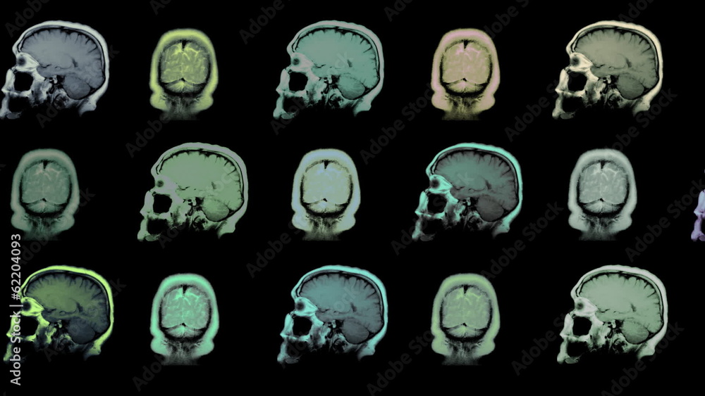 Computed tomography of the human brain. Animated background.