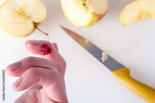 Finger cut