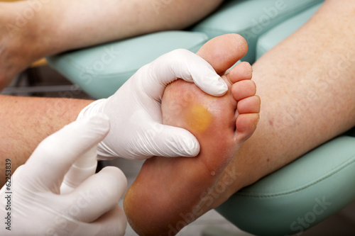 Fußpfleger besprüht Fußsohle mit Desinfektionsmittel photo
