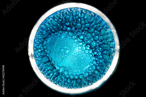 blue cells dividing form a bigger one