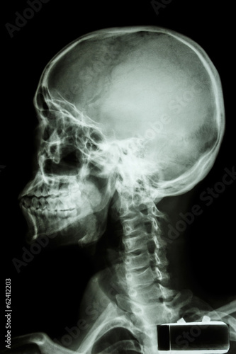 human's skull and cervical spine