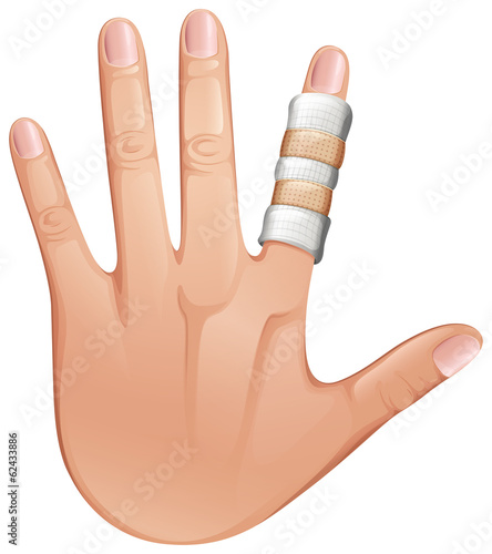 A first aid treatment on a finger