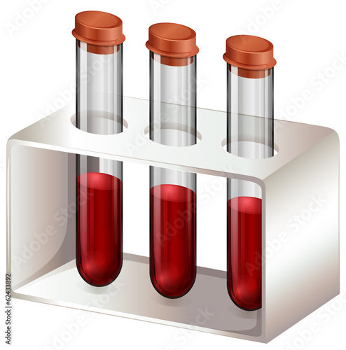 Test tubes with blood samples