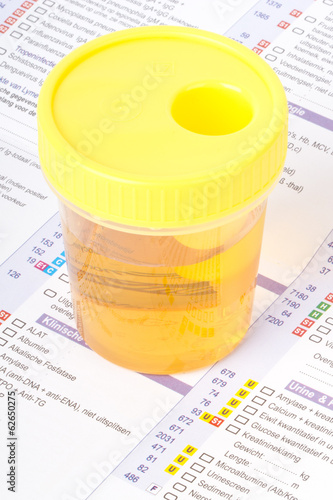 Urine sample on a lab form