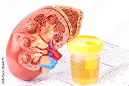 Kidney, urine sample and lab form