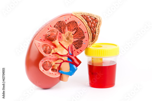 Kidney and bloody urine
