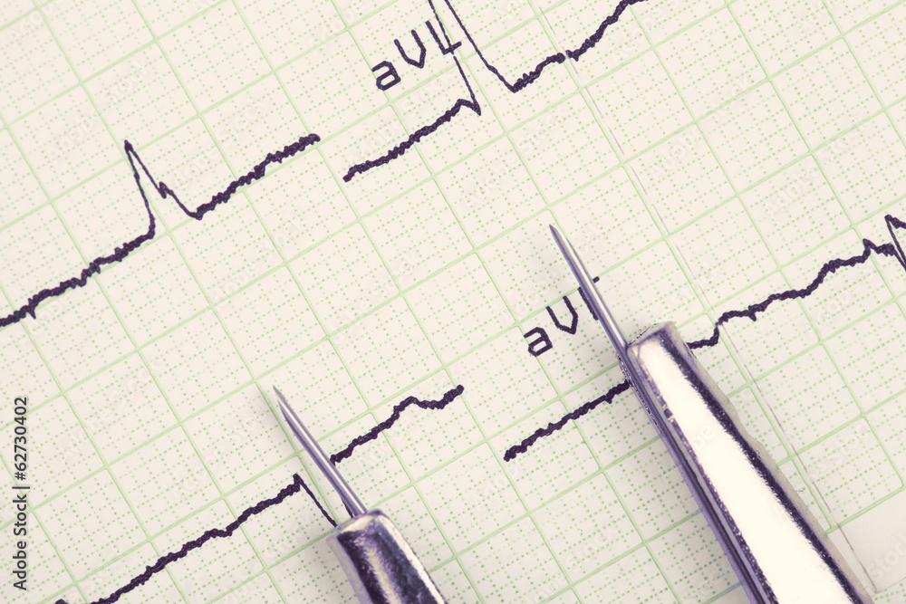 instrument and cardiogram. medical background instrument and cardiogram. medical background
