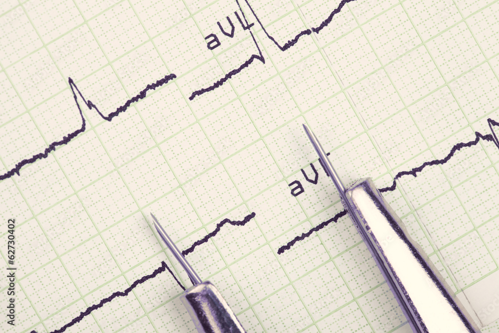 instrument and cardiogram. medical background