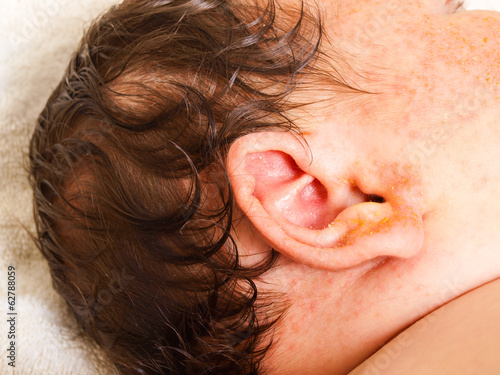 Newborn baby