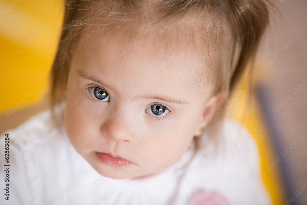 Emotions of a little girl with Down syndrome Emotions of a little girl with Down syndrome