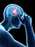 illustration of a man having a headache