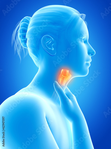 medical illustration of a female with an inflamed larynx