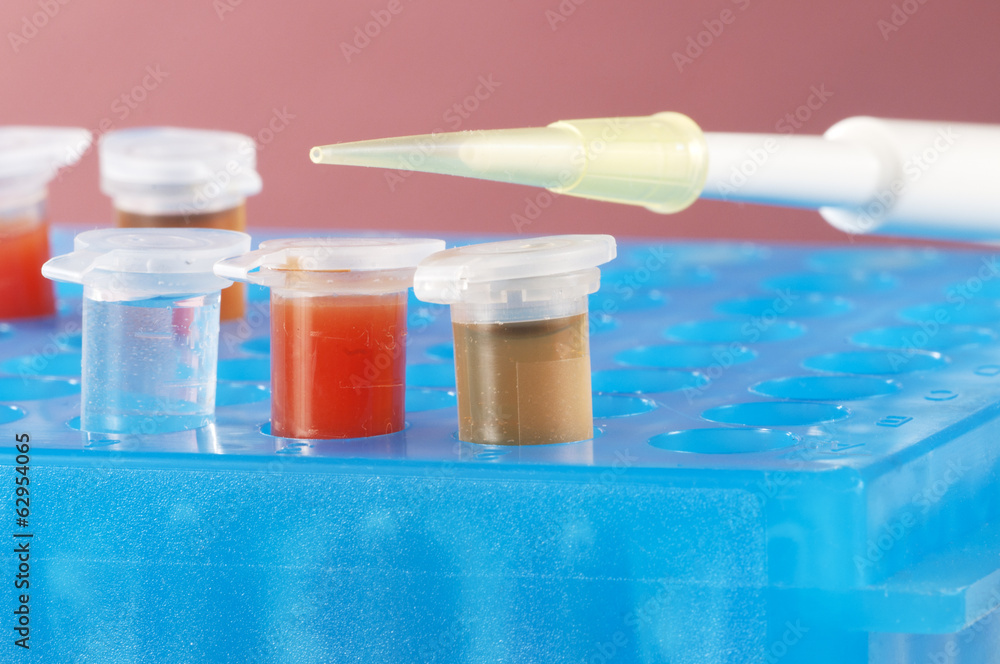 Test tubes with different colored chemicals in a plastic support Test tubes with different colored chemicals in a plastic support