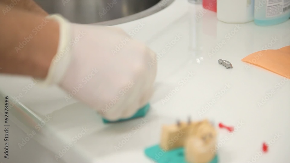 dental dentist objects implants