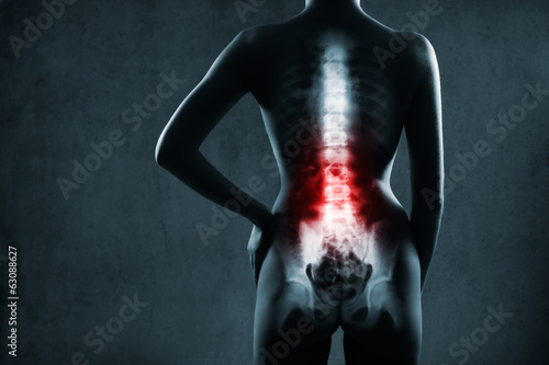 Spine in x-ray. The lumbar spine is highlighted by red colour.