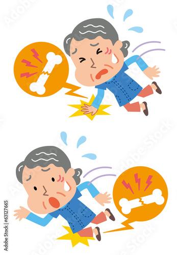 転倒　骨折　腕　脚　高齢者
