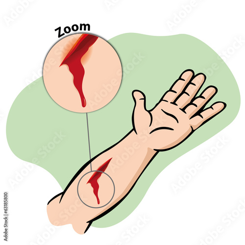 First Aid wound with blood