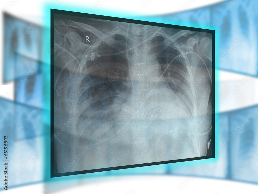 x-ray technology x-ray technology