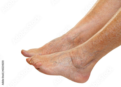 Canvas Print Elderly feet