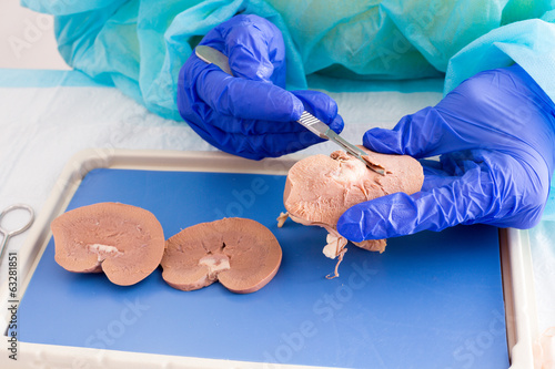 Medical student in anatomy dissecting a kidney