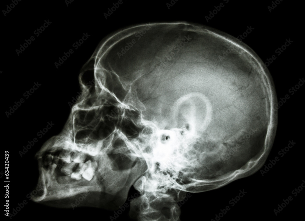 X-ray asian skull and cervical spine X-ray asian skull and cervical spine