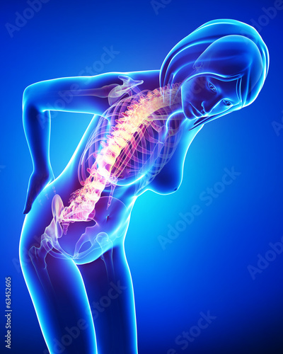 Anatomy of female back pain in blue