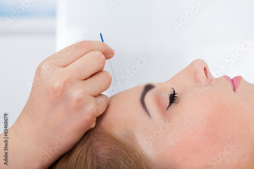 Woman Getting Acupuncture Treatment © Andrey Popov