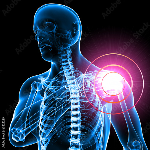 Anatomy of male Shoulder pain in black